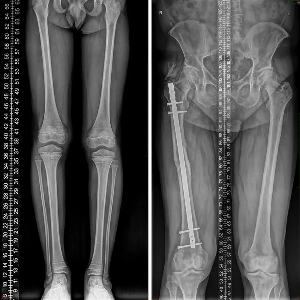 radiografie ortoleg imagistica edenta