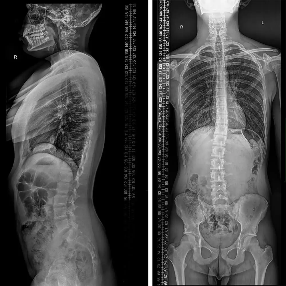 radiografie ortospine imagistica edenta