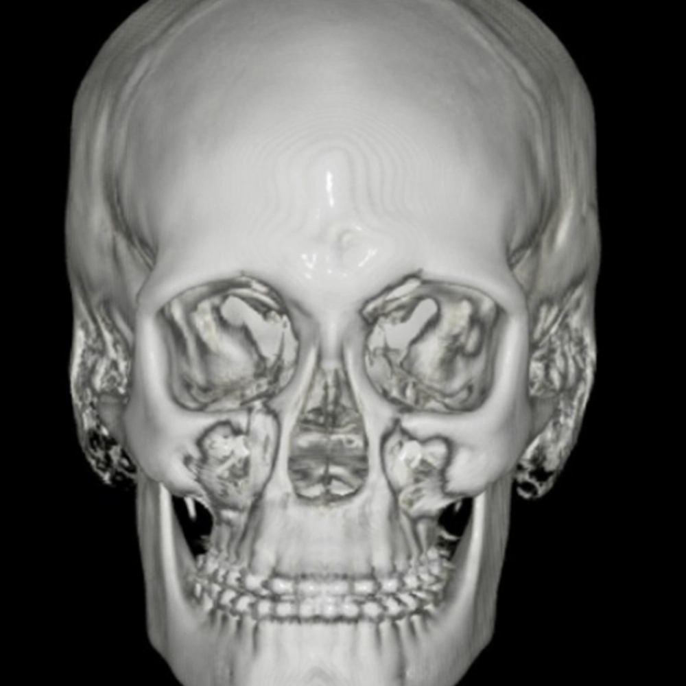 radiografie craniu edenta