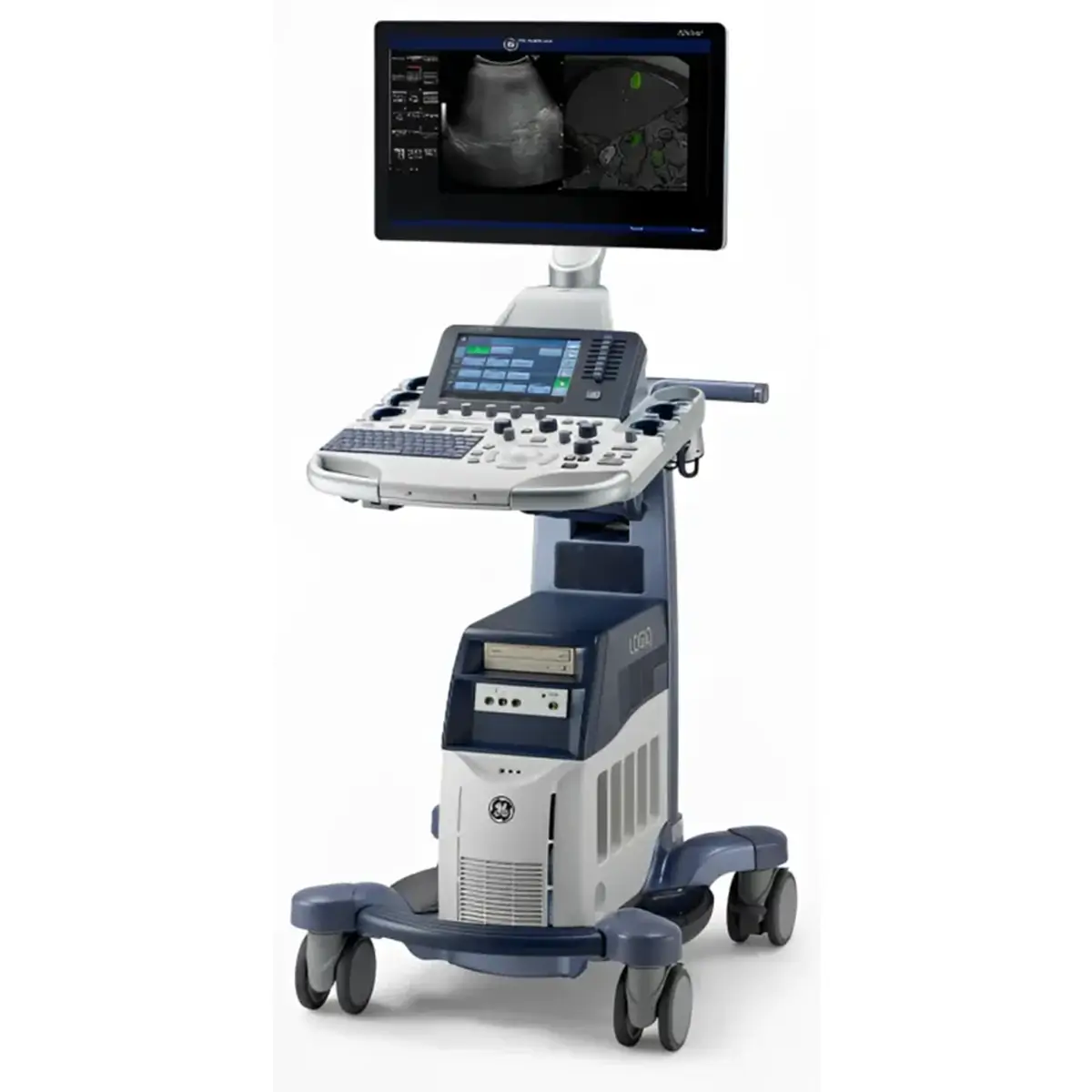 echipament diagnostic ecografie logiq s8 general electric