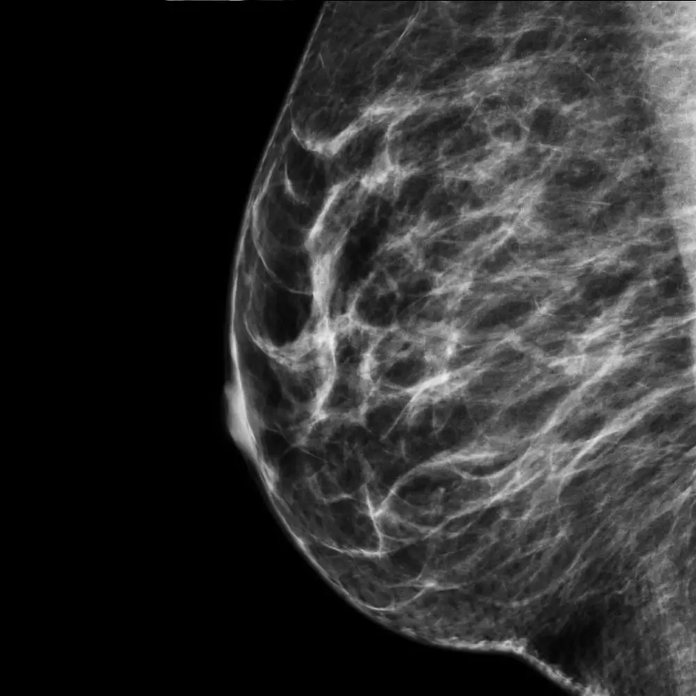 radiografie mamografie edenta radiologie