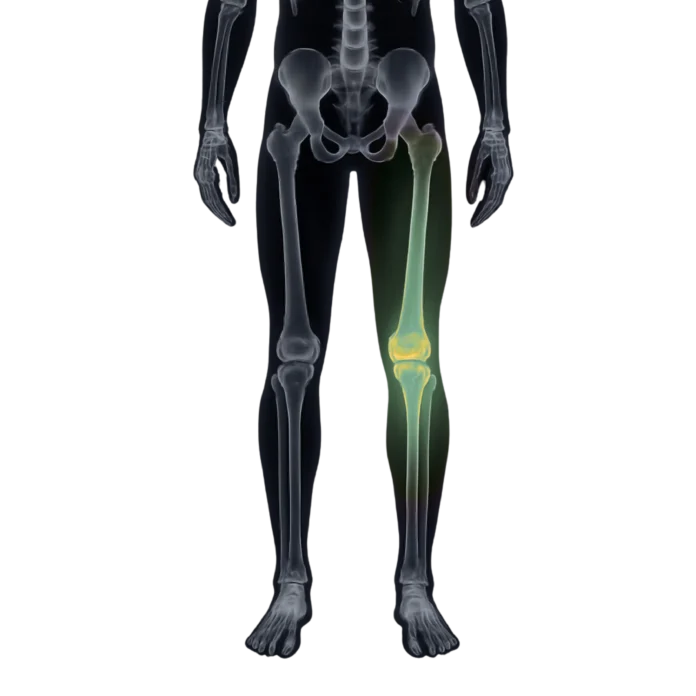 radiografie picior pret edenta iasi