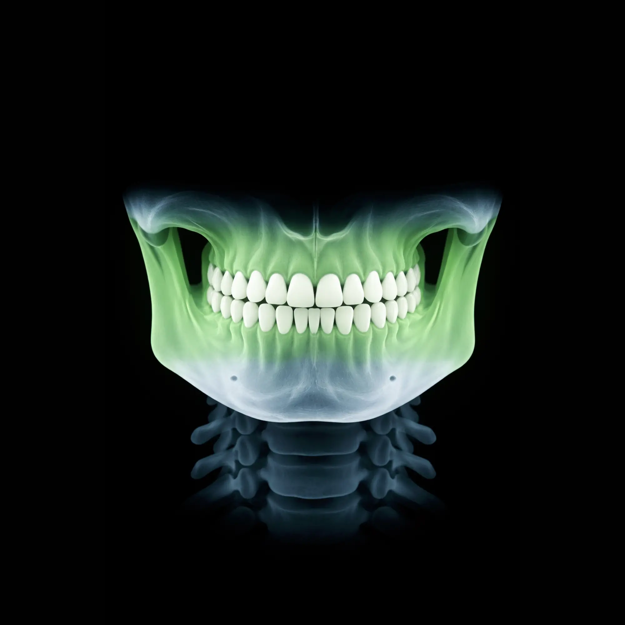radiografie dentara edenta independentei