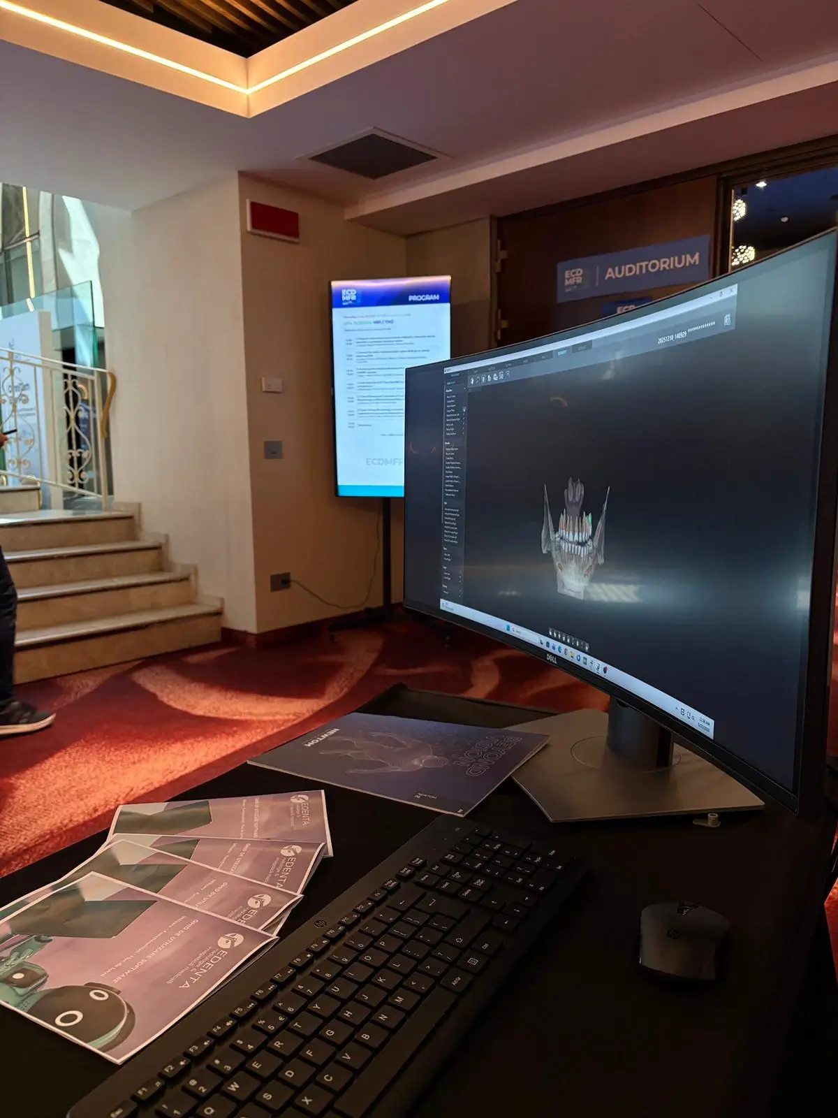Edenta Radiologie & Imagistică Medicală la ECDMFR 2026: Inovație și tehnologie de vârf în Radiologia Dento-Maxilo-Facială 2 edenta radiologie echipa eveniment ecdmfr 2026 5